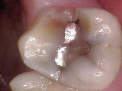 14jul15endosimmonscantsave02 14jul15endosimmonscantsave02