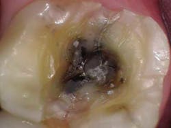 14jul15endosimmonscantsave03 14jul15endosimmonscantsave03