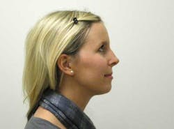 14jul17orthomillerclearcorrect03 14jul17orthomillerclearcorrect03