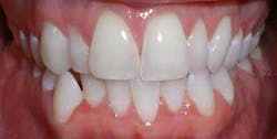 14jul17orthomillerclearcorrect04 14jul17orthomillerclearcorrect04