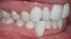 14jul17orthomillerclearcorrect05 14jul17orthomillerclearcorrect05