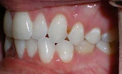 14jul17orthomillerclearcorrect06 14jul17orthomillerclearcorrect06