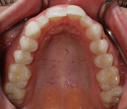 14jul17orthomillerclearcorrect07 14jul17orthomillerclearcorrect07