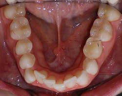 14jul17orthomillerclearcorrect08 14jul17orthomillerclearcorrect08