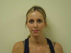 14jul17orthomillerclearcorrect10 14jul17orthomillerclearcorrect10