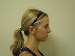 14jul17orthomillerclearcorrect11 14jul17orthomillerclearcorrect11