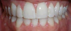 14jul17orthomillerclearcorrect12 14jul17orthomillerclearcorrect12