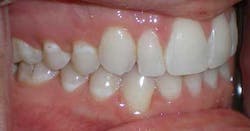 14jul17orthomillerclearcorrect13 14jul17orthomillerclearcorrect13