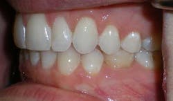 14jul17orthomillerclearcorrect14 14jul17orthomillerclearcorrect14