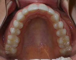 14jul17orthomillerclearcorrect15 14jul17orthomillerclearcorrect15