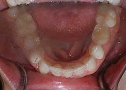 14jul17orthomillerclearcorrect16 14jul17orthomillerclearcorrect16