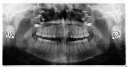 14jul17orthosimmons01 14jul17orthosimmons01