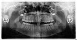 14jul17orthosimmons01 14jul17orthosimmons01