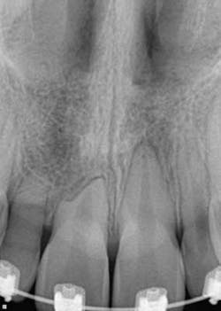 14jul17orthosimmons02 14jul17orthosimmons02