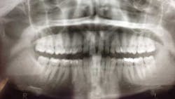 14jul17orthosimmons03 14jul17orthosimmons03