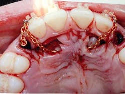 14jul17orthosimmons05 14jul17orthosimmons05