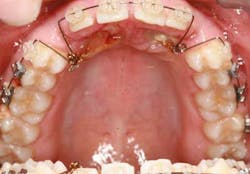 14jul17orthosimmons06 14jul17orthosimmons06