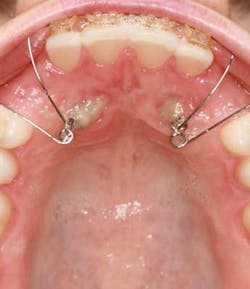 14jul17orthosimmons07 14jul17orthosimmons07