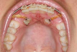 14jul17orthosimmons08 14jul17orthosimmons08