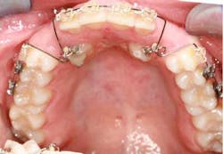 14jul17orthosimmons09 14jul17orthosimmons09