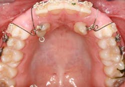 14jul17orthosimmons10 14jul17orthosimmons10