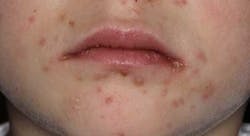 14junesimmonsaphg03 14junesimmonsaphg03