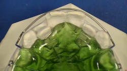 14marbfsperronehawleygreatlakesorthoindivtoothmvmtwfingersprings 14marbfsperronehawleygreatlakesorthoindivtoothmvmtwfingersprings