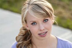 14marbfsperroneorthodontics 14marbfsperroneorthodontics