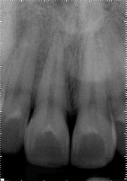 14may20endolandwehrreferredpainantpreop 14may20endolandwehrreferredpainantpreop