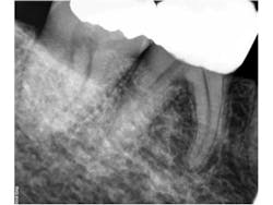 14nov18endopetrino01 14nov18endopetrino01