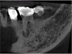 14nov18endopetrino02 14nov18endopetrino02