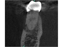 14nov18endopetrino03 14nov18endopetrino03