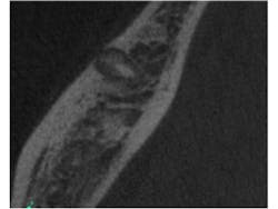 14nov18endopetrino04 14nov18endopetrino04