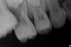 14oct16bfssimmons02 14oct16bfssimmons02