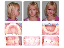 14oct16bfssimmons04 14oct16bfssimmons04