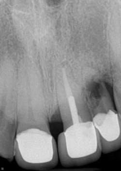 14sept16endosimmons Resorption01 14sept16endosimmons Resorption01