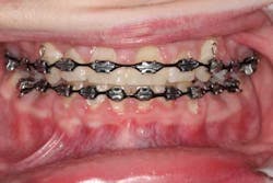 14sept18bfssimmons01 14sept18bfssimmons01