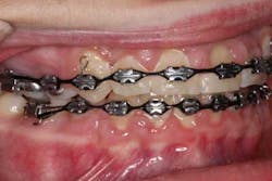 14sept18bfssimmons02 14sept18bfssimmons02