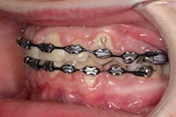 14sept18bfssimmons03 14sept18bfssimmons03