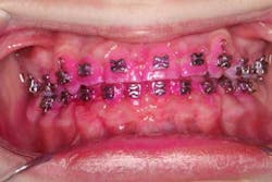 14sept18bfssimmons04 14sept18bfssimmons04