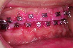 14sept18bfssimmons05 14sept18bfssimmons05