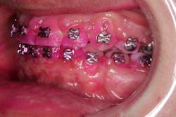 14sept18bfssimmons06 14sept18bfssimmons06