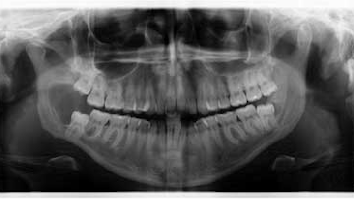 14simmonsoralcancerdiagnosisprepan