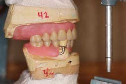 14srrsimmonsdentures07 14srrsimmonsdentures07