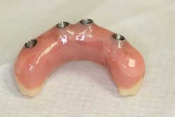 14srrsimmonsdentures08 14srrsimmonsdentures08