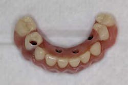 14srrsimmonsdentures09 14srrsimmonsdentures09