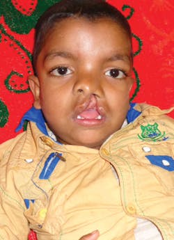 1503apxins Before 1503apxins Before