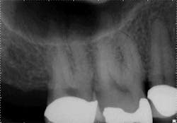 15jan20endolandwehr01 15jan20endolandwehr01