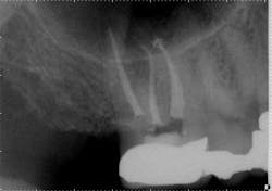 15jan20endolandwehr02 15jan20endolandwehr02