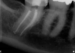 15jan20endolandwehr04 15jan20endolandwehr04